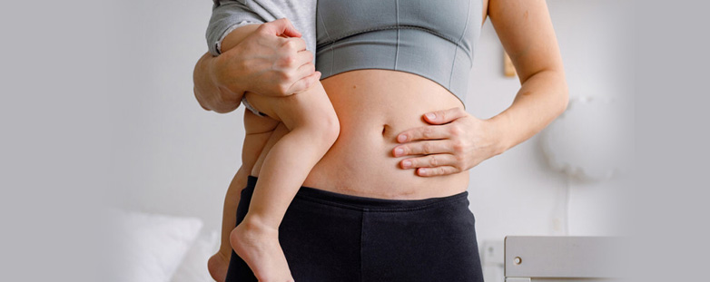 Caesarean Child Delivery, C Section Delivery